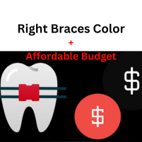 Teal Braces | How To Choose The Right Braces For Your Budget
